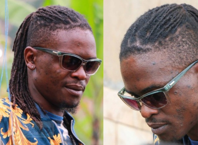 Weasel Manizo Reportedly Facing A Terrible Face Disease