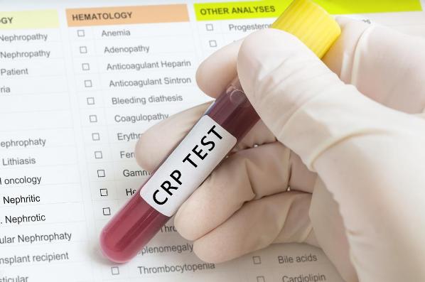 What Is A Normal CRP Test