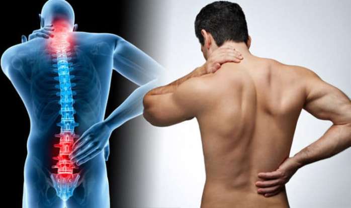 Understanding And Managing Back Pain A Comprehensive Guide
